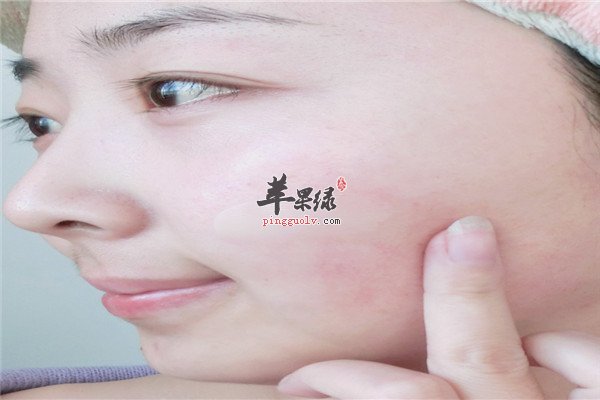 敏感肌肤6.jpg