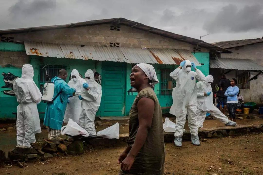 埃博拉病毒病人图片