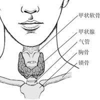 什么是碘缺乏病？