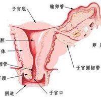 子宫颈糜烂的防治