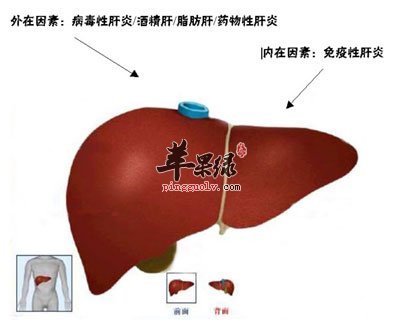 脂肪肝