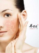 皮肤出油暗黄如何保