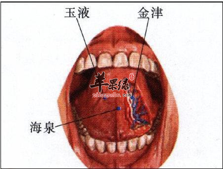 刺舌下两边大脉出血《针灸大全》列作奇穴,名金津,玉液