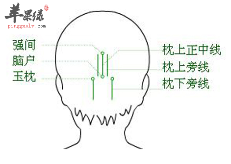 强间穴穴位位置图_强间穴的功效与作用_疗法及注意事项