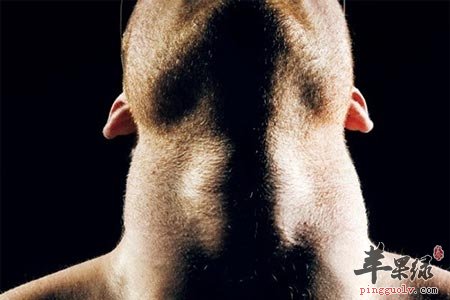 男性脖子粗要小心 影响生育产生高血压