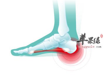 足跟疼痛饮食要注意哪些