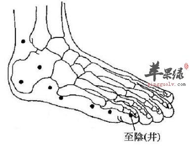 艾灸至阴穴能治疗胎位不正