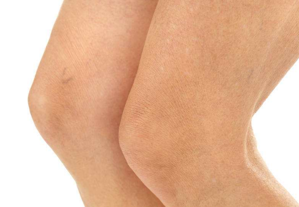 膝盖疼是哪些原因造成的