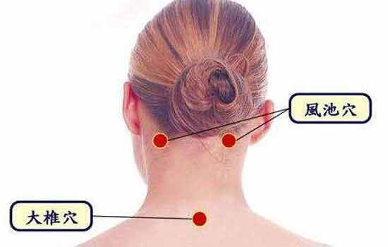 适合治疗颈椎病的5大穴位