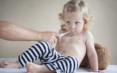 儿童患上水痘怎么办 要注意护理好