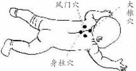 身柱穴位很重要 教你按摩好方法