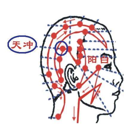 天冲部位疼痛的原因 这些情况导致