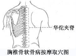 孕吐严重按摩哪里