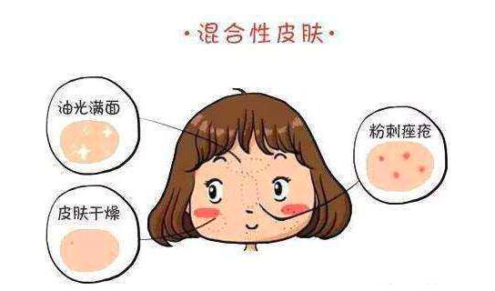 混合性皮肤怎么调理