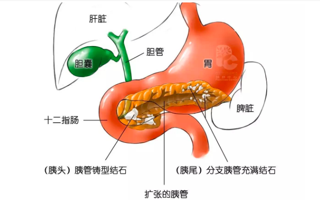 QQ截图20210305114816.png