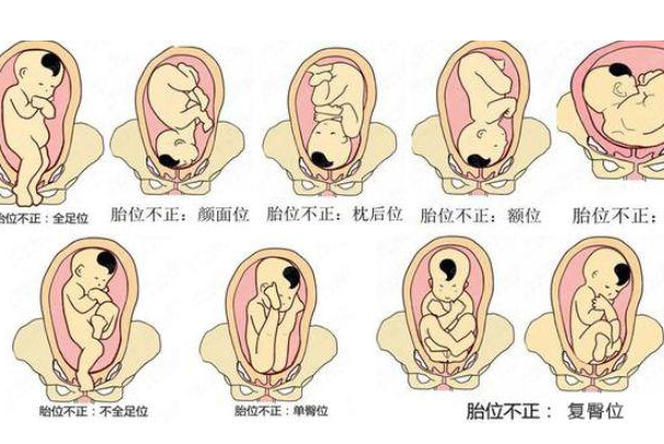 怀孕22周宝宝胎位图图片